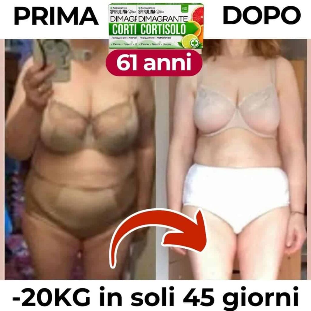 Prima e dopo la perdita di peso di 20kg in 45 giorni.