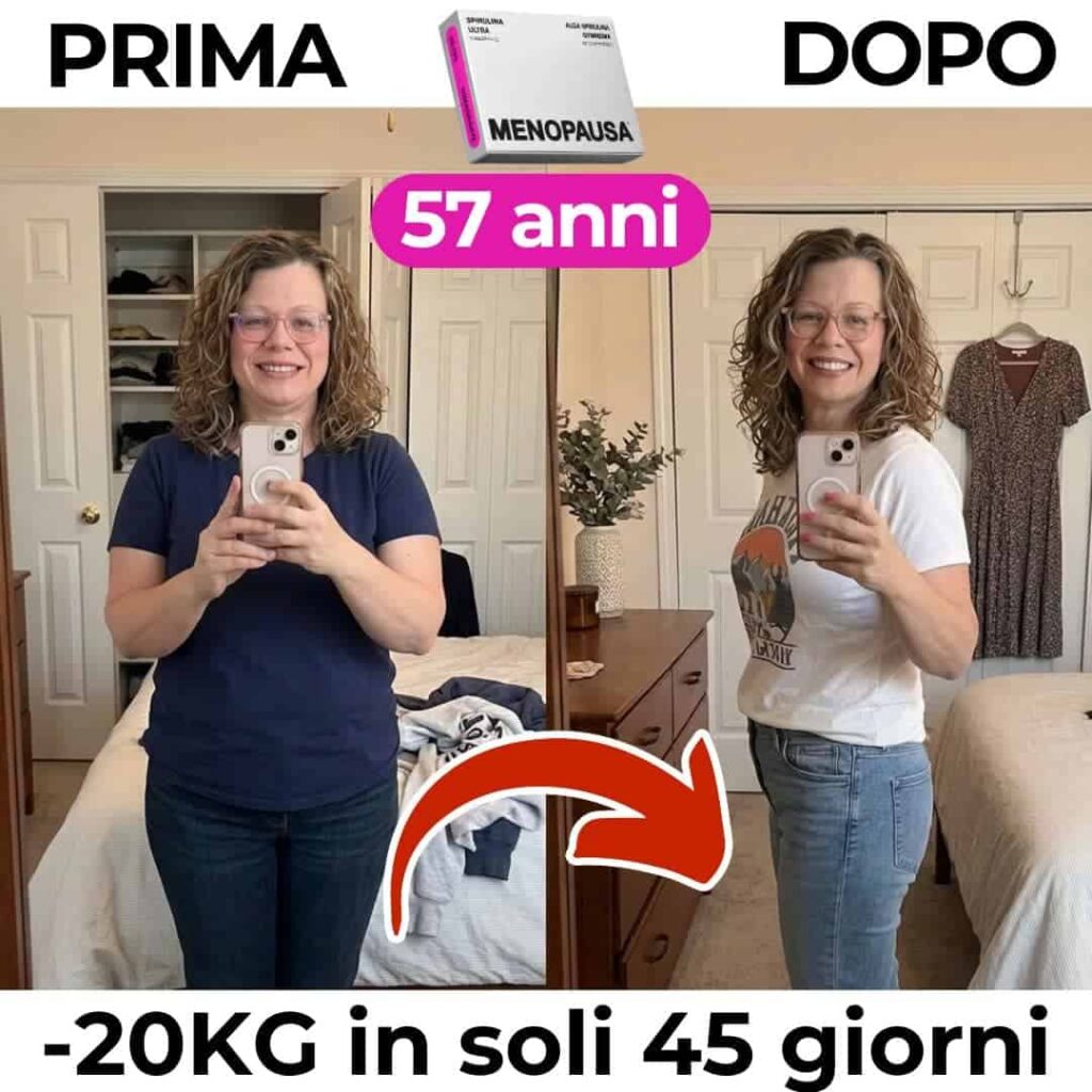 Donna felice prima e dopo 20kg persi in 45 giorni.