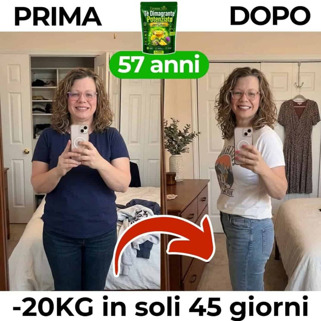 Donna felice prima e dopo perdita di peso di 20kg.